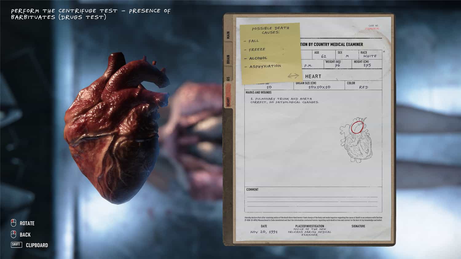 验尸模拟器/Autopsy Simulator|官方简体中文|支持键盘.鼠标